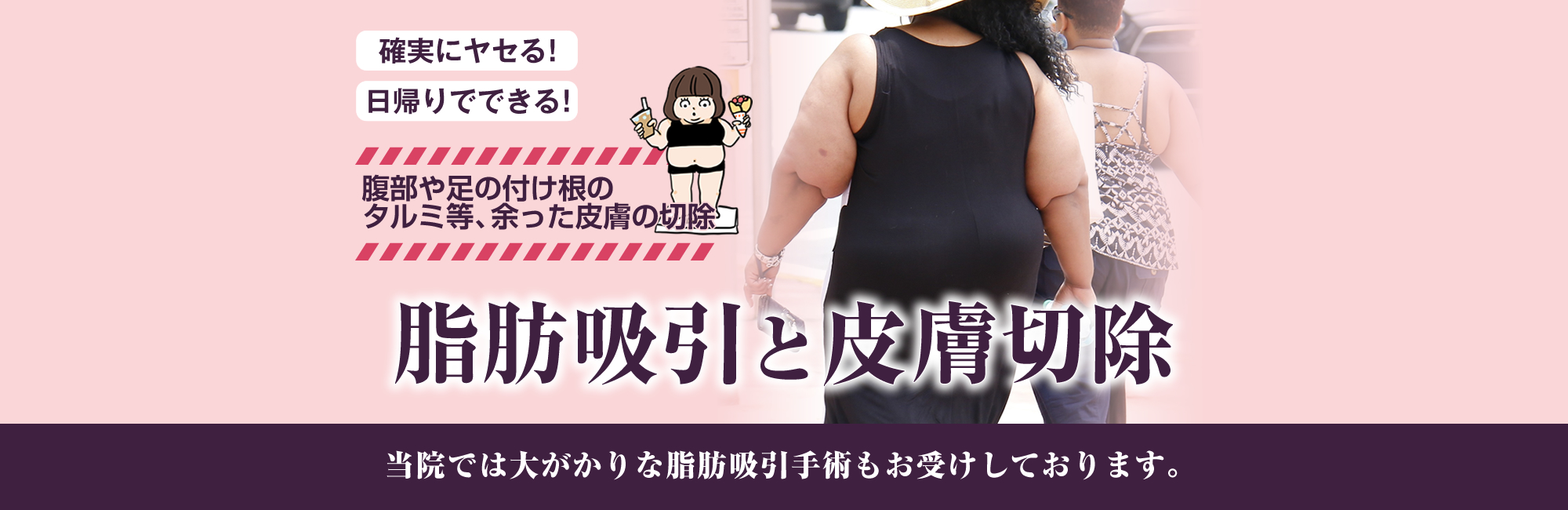 確実にヤセる！日帰りでできる！腹部や足の付け根のタルミ等、余った皮膚の切除。脂肪吸引と皮膚切除。当院では大がかりな脂肪吸引もお受けしております。