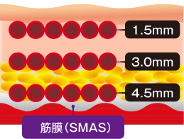 皮膚の断面図