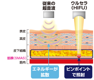 皮膚の断面図