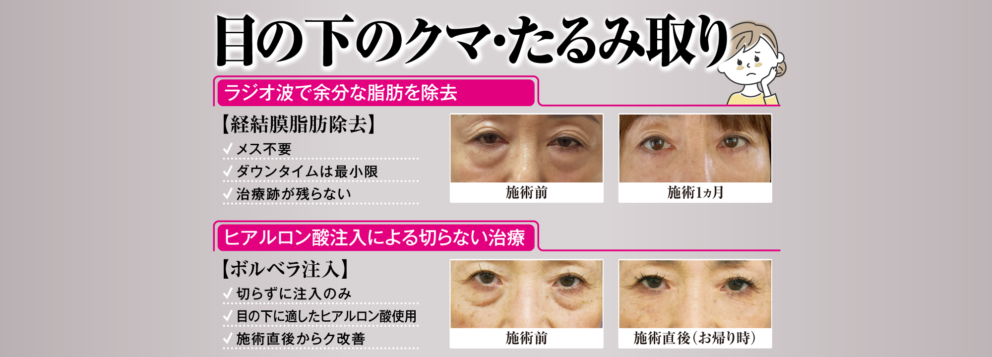 目の下のクマ・たるみ取り[目の下のクマ・たるみ取り][目の下のクマ・たるみ取り]