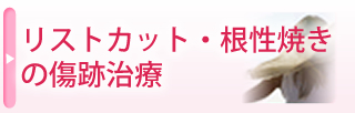 リストカット・根性焼きの傷跡治療