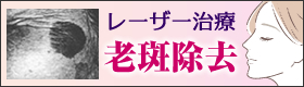 老班除去