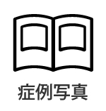 症例写真