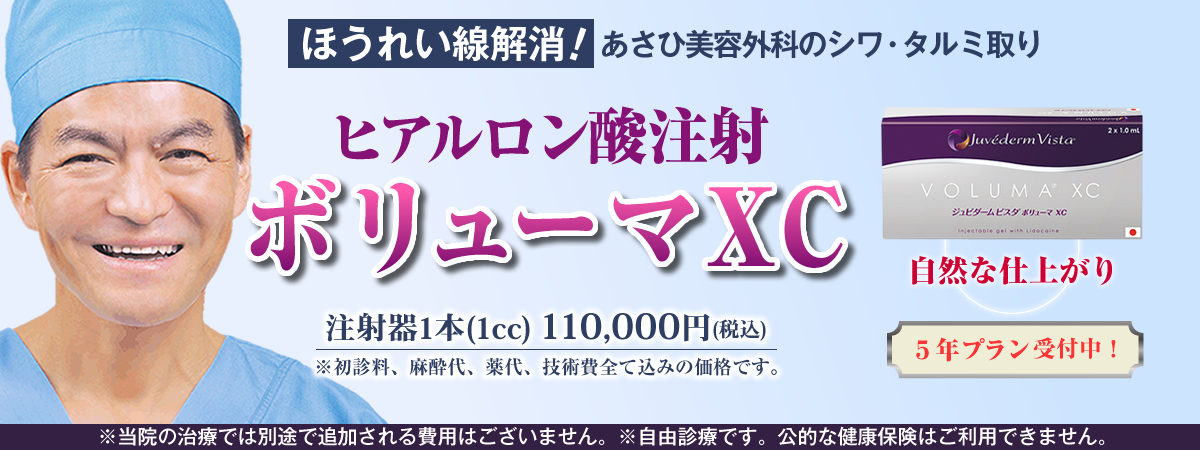 ほうれい線解消！あさひ美容外科のシワ・タルミ取り。ヒアルロン酸注射ボリューマXC。厚生労働省認可。注射のみ。切らない。長期持続。5年持続プラン受付中！(施術後2年～3年以内の再注入は通常の半額で施術できます。)