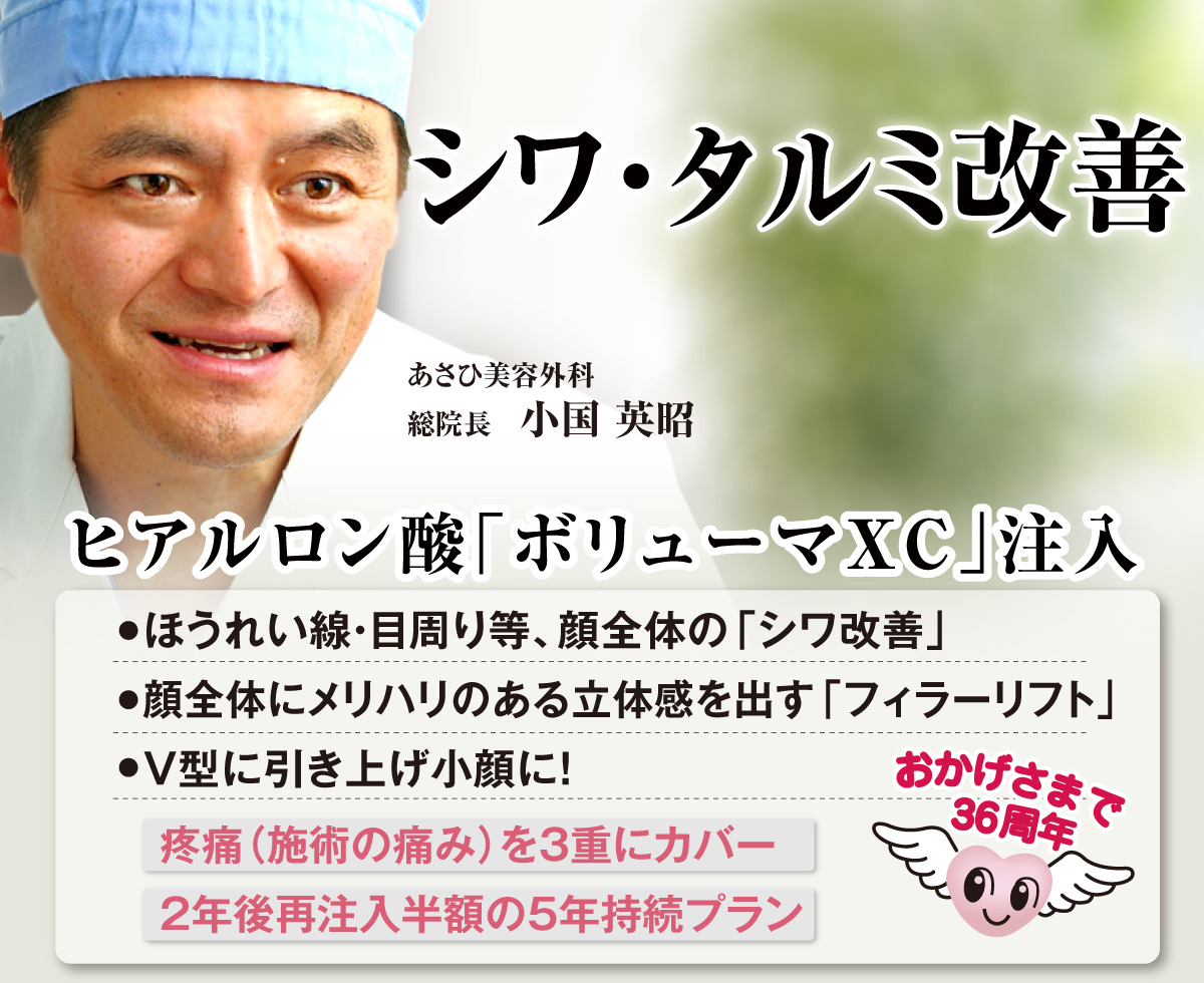 ほうれい線解消!あさひ美容外科のシワ・タルミ取り。ヒアルロン酸注射ボリューマXC。厚生労働省認可。注射のみ。切らない。長期持続。5年持続プラン受付中!(施術後2年~3年以内の再注入は通常の半額で施術できます。)