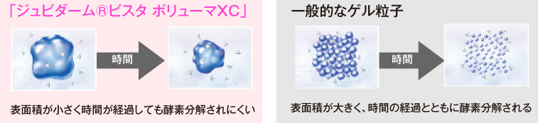ジュビダームビスタ® ボリューマXC