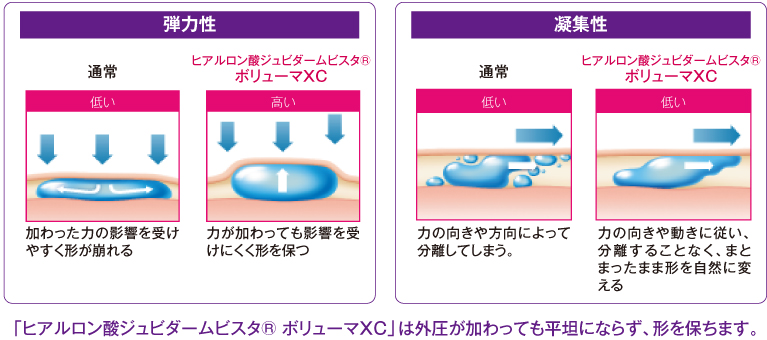 ボリューマXCのリフト効果