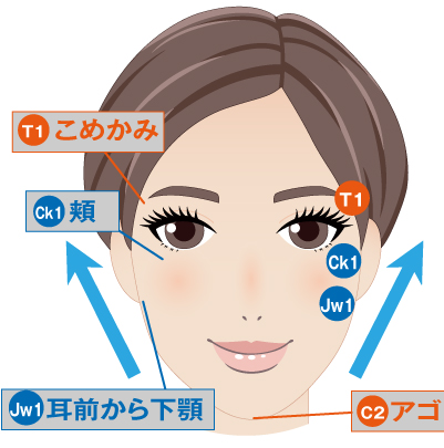 Vリフト注入