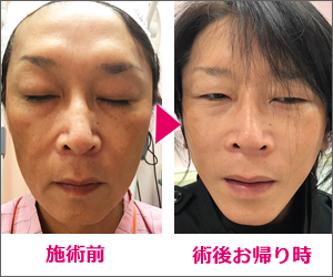 モニター紹介 公式 あさひ美容外科