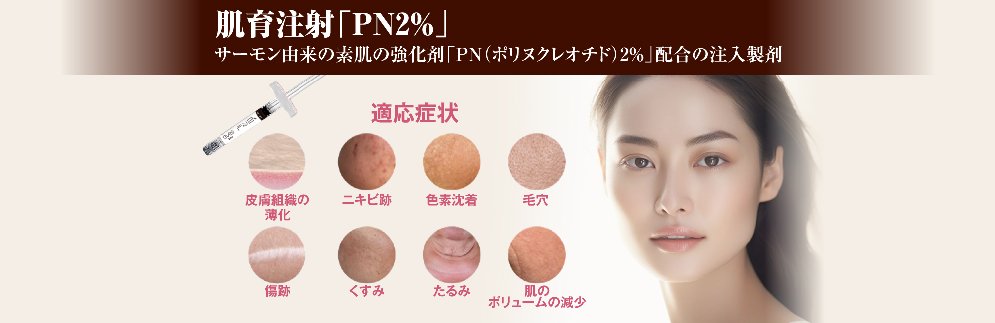 ヒアルロン酸注入