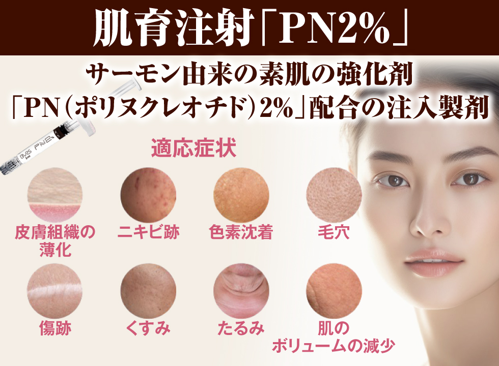 ヒアルロン酸注入