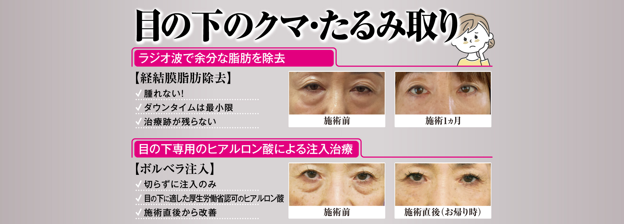 目の下のクマ・たるみ取り[目の下のクマ・たるみ取り][目の下のクマ・たるみ取り]