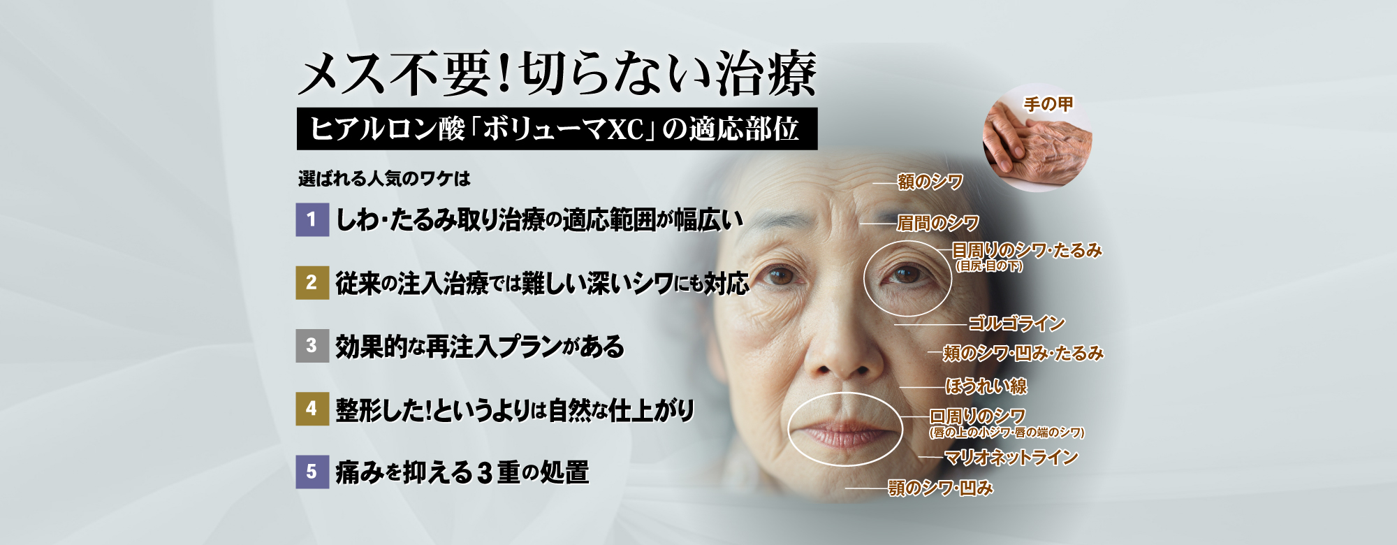 ヒアルロン酸注入