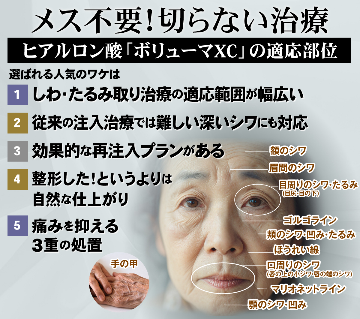 ヒアルロン酸注入